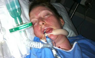 How post-orgasm pain left British woman paralysed since 2012