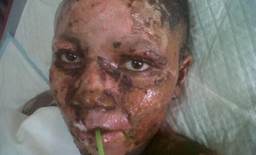 Ogechi, Nyanya blast victim, dies ‘in pains’