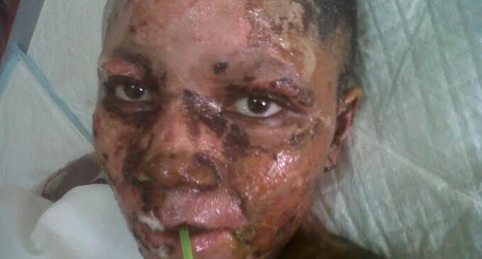 Ogechi, Nyanya blast victim, dies ‘in pains’