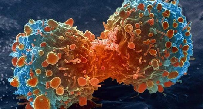 Is the treatment for cancer finally here?