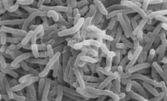One dead, 55 hospitalised as Cholera hits Kaduna school