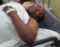 SURVIVOR: Abuja blast hit my arm and leg