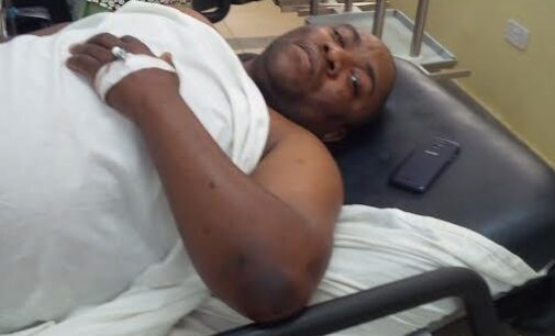 SURVIVOR: Abuja blast hit my arm and leg