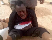 Shi’ites warn: There’ll be crisis if Zakzaky goes blind