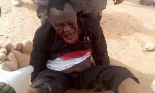 PICTURED: Shi’ia’s Zakzaky soaked in blood
