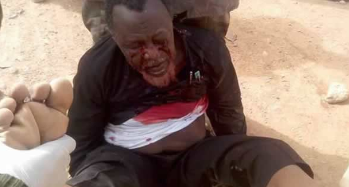 PICTURED: Shi’ia’s Zakzaky soaked in blood