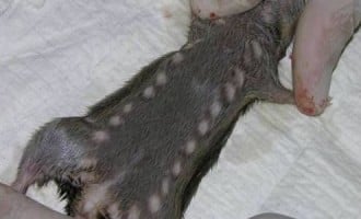 NCDC: Lassa fever killed 85 people in 19 states