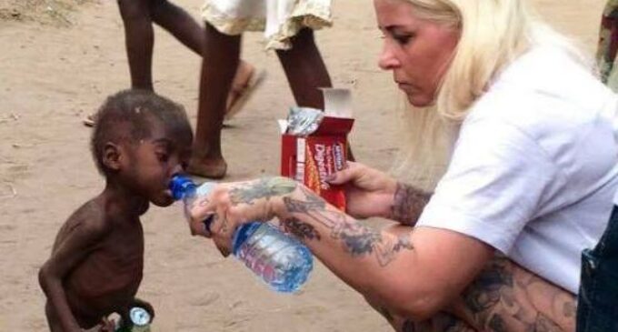 Saved by charity… Hope, Nigerian ‘witch-child’ left for dead, is on the road to recovery