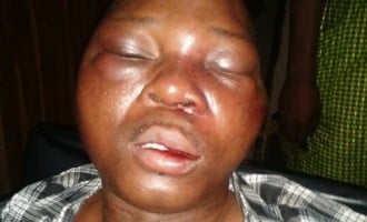 Court to hear suit on ‘assault’ of journalist by customs