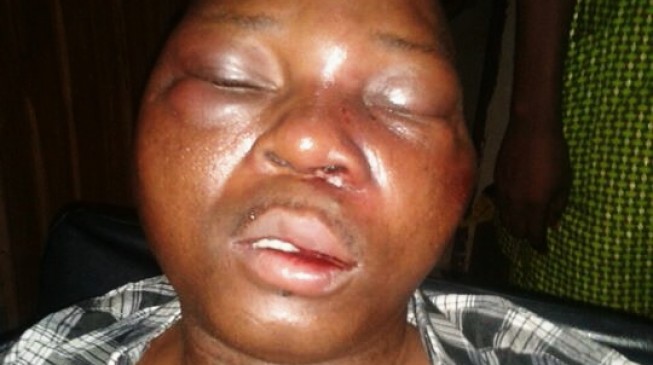Court to hear suit on ‘assault’ of journalist by customs