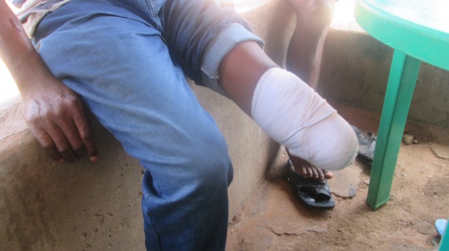 FORGOTTEN SOLDIERS I: ‘Maggots in my leg’… an amputee-soldier’s 44 months of begging the army for ‘original’ prosthesis