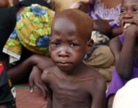 ALERT: 184 children ‘will die’ of malnutrition every day in the north-east