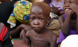 Yobe has the most cases of malnutrition in Nigeria, says WFP