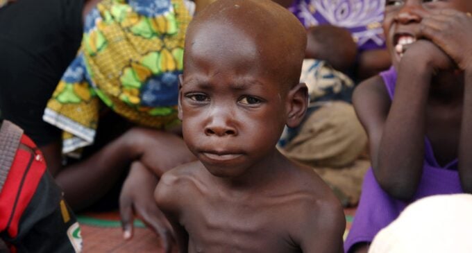 Yobe has the most cases of malnutrition in Nigeria, says WFP
