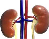 Self-medication damages the kidney, says doctor