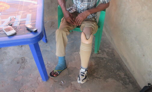HURRAY! Army finally gives prosthesis to a ‘forgotten soldier’