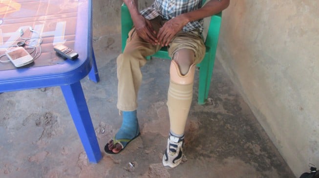HURRAY! Army finally gives prosthesis to a ‘forgotten soldier’