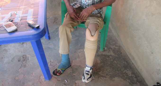 HURRAY! Army finally gives prosthesis to a ‘forgotten soldier’