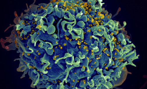 Five HIV patients left ‘virus free’ after undergoing vaccine therapy