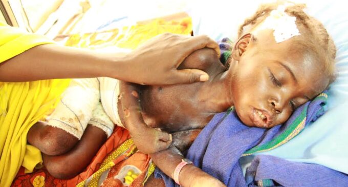 UNDERCOVER: In Borno, children are dying at IDP camps, foodstuffs are ‘disappearing’ at SEMA store
