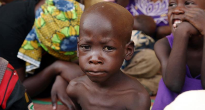 ’10 million’ under-five children in Nigeria malnourished
