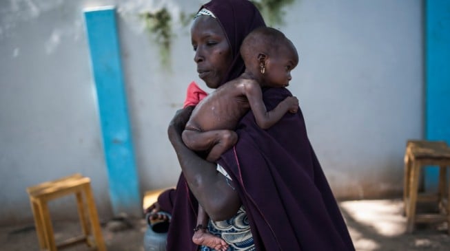Malnutrition ‘could kill’ 1.4m children in Nigeria, Somalia, Sudan, Yemen in 2017
