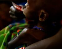Malnutrition: UN says Nigeria among worst-hit countries, calls for urgent action