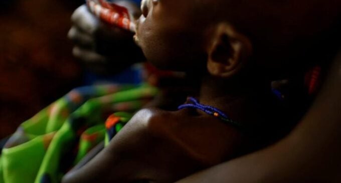 UNICEF: 100 children under five die of malnutrition in Nigeria every hour