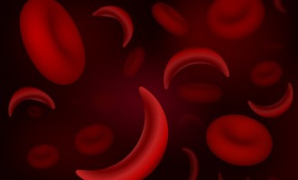 Research: Genetic mutation created sickle cell anemia