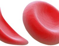 ‘Nigeria has highest rate of sickle cell anaemia in the world BUT no money for cure’