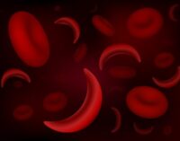 Research: Genetic mutation created sickle cell anemia