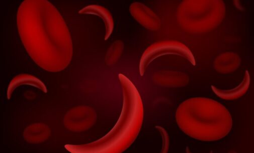 How Nigeria’s interior ministry can end sickle cell diseases