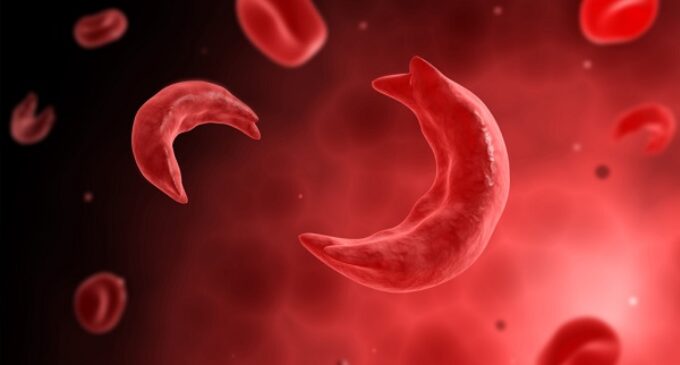 HURRAY! First successful ‘cure’ of sickle cell recorded in France