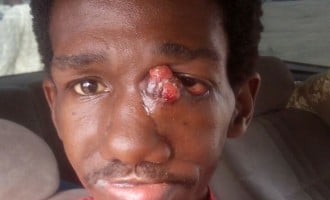 Help! This pastor and motivational speaker needs your support to stay alive