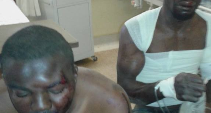 Two Nigerians beaten mercilessly in South Africa