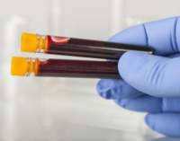 Scientists develop blood test ‘that can detect early-stage cancer’