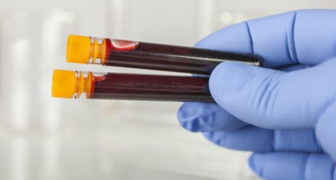 UK to roll out ‘revolutionary’ new treatment for sickle cell disease
