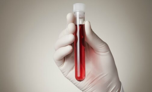 Scientists develop blood test that can detect cancer four years before symptoms