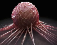 Scientists team up to uncover earliest symptoms of cancer
