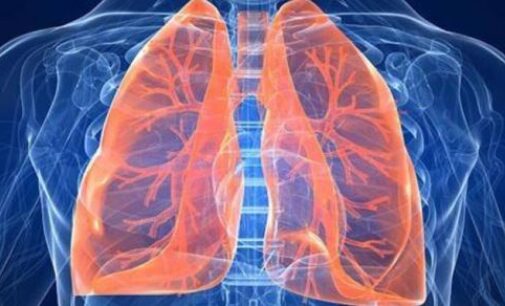 Study: Lung transplant recipients have higher risk of organ failure, death