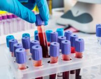 Blood test that ‘detects 50 types of cancer’ before symptoms discovered