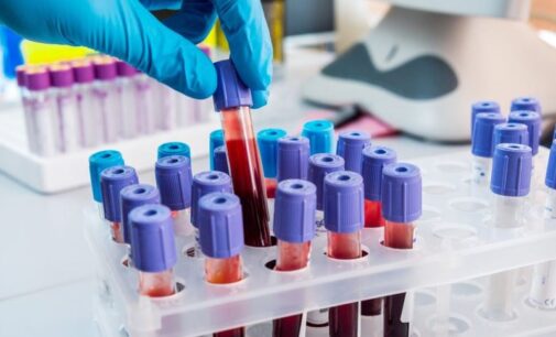 Game Changer: UK begins trial of blood test that can detect 50 types of cancer