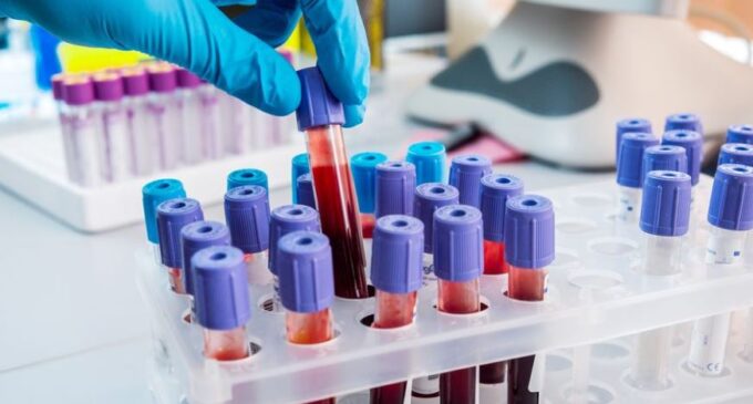 Game Changer: UK begins trial of blood test that can detect 50 types of cancer