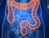 ALERT! 45 is new age to start colorectal cancer screening