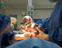Study: Why C-section babies are at risk of certain diseases