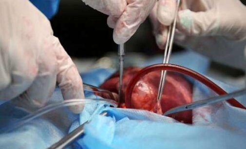 Doctors bring dead heart ‘back to life’ — in first of its kind surgery in the US