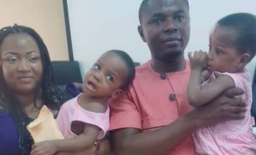 National Hospital discharges separated conjoined twins