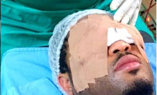 ‘Over 8 hours, I was without sight’ — Mike Ezuruonye speaks after eye surgery