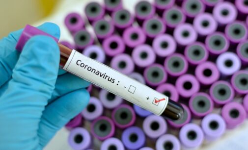 Nigerian tests positive for coronavirus in the US