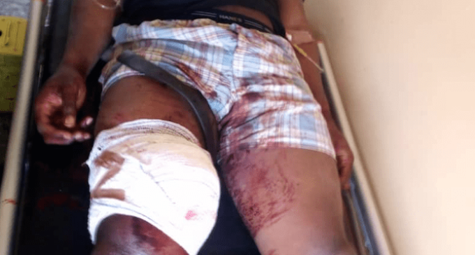 PHOTOS: Police pilots wounded by Ansaru militants in attack on helicopter